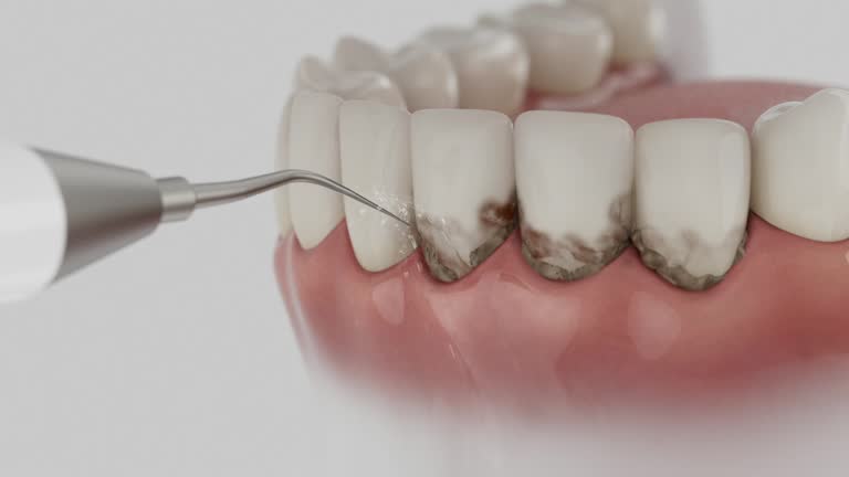 Trusted Tooth Extraction service in Napili-Honokowai, HI - Dentist Open Now